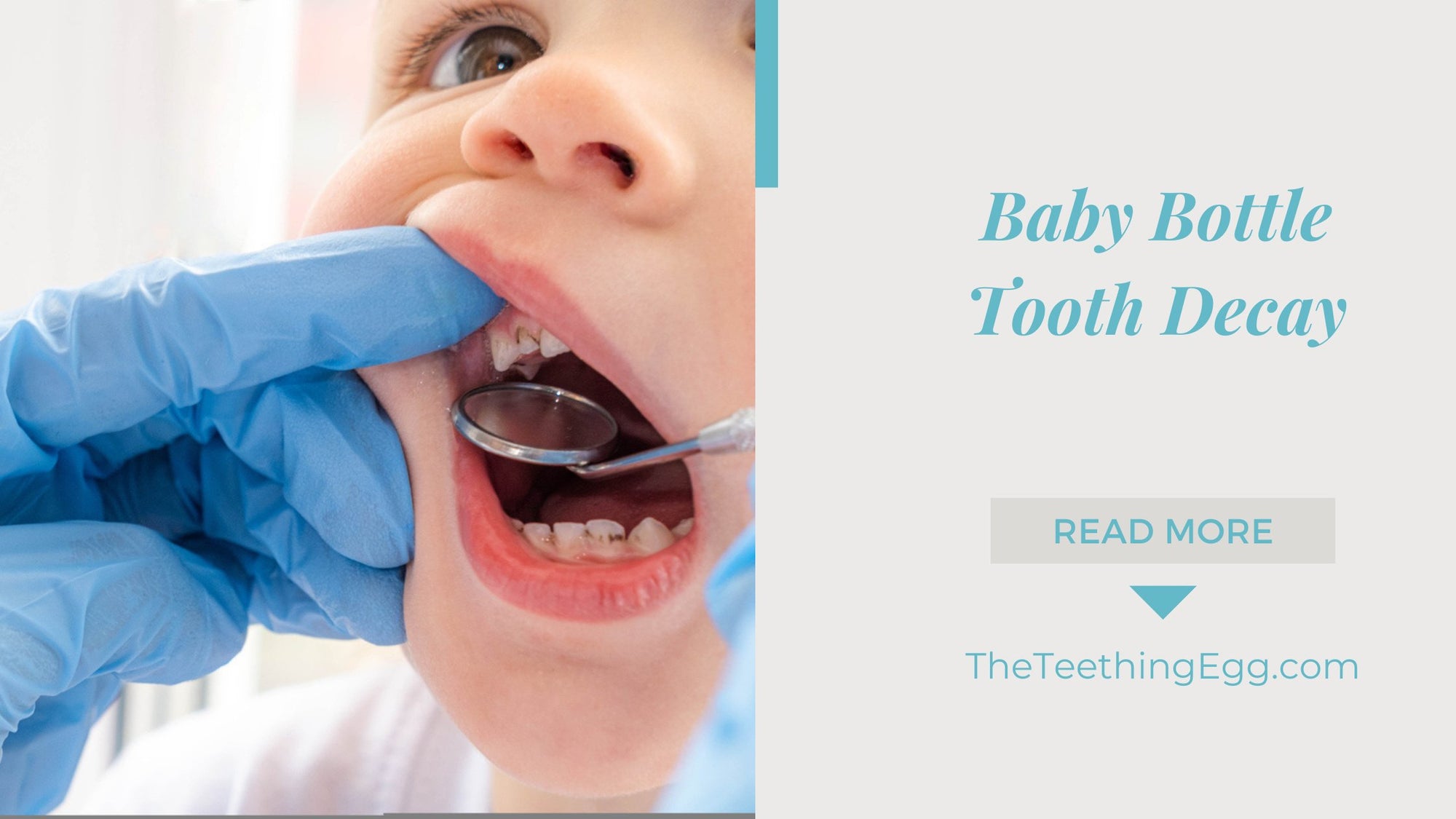 Baby Bottle Tooth Decay: Prevention and Care for Your Child’s Dental Health